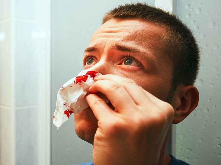 What Can Cause Multiple Nosebleeds In A Day