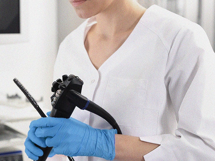 What are the different types of colon polyps?