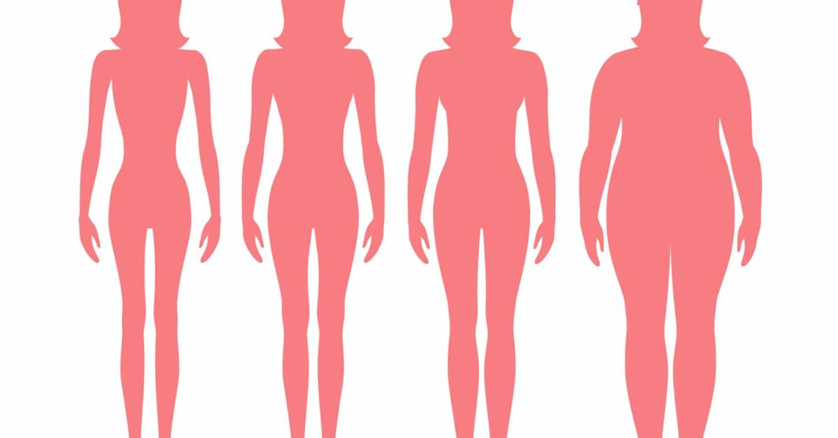 Anorexia Nervosa Comes in All Sizes, Including Plus Size